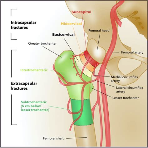 Bony and vascular anatomy of the proximal femur (adapted from [8]) | Download Scientific Diagram