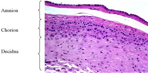 Fetal Membranes Histology | My XXX Hot Girl