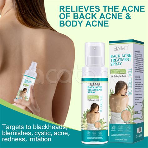 Back Acne Treatment Spray, 120ml | Elaimei