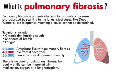 Nov 19 | Greater Hartford Pulmonary Fibrosis Support Group | West ...