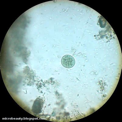 The Wonderful Microworld: Microorganisms in water.