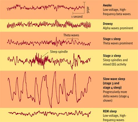 Why sleep? No, actually, why wake? - Biology Stack Exchange