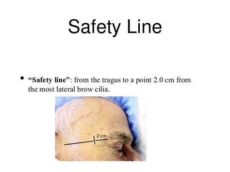 Temporal artery biopsy