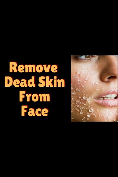 Remove Dead Skin From face | Exfoliate face, Dead skin, Skincare video