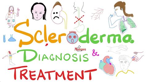 Scleroderma Diagnosis and Management - YouTube