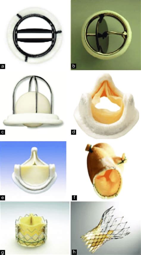 Different types of prosthetic valves. (a) Bileaflet mechanical valve ...