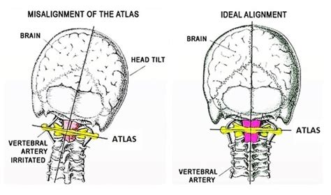 Welcome to Atlas Orthogonal Health - Home