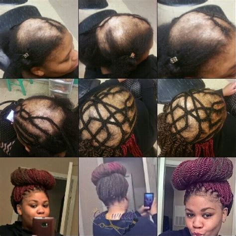 13+ Fine Beautiful Hairstyle To Cover Bald Spot Women