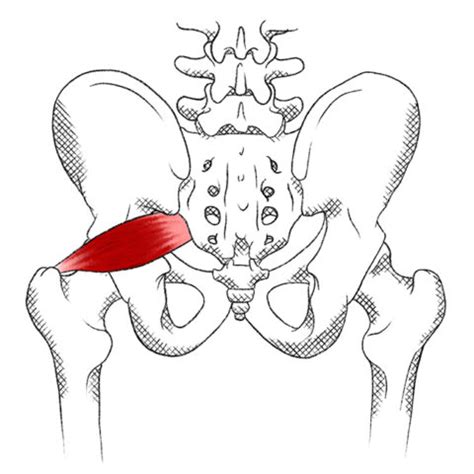 Piriformis – Pain & Trigger Points