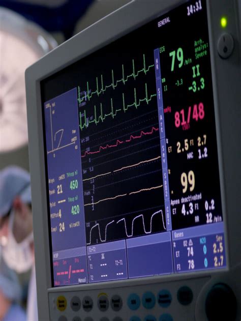 How to Diagnose Atrial Fibrillation (AFib) with Heart Rate Monitor