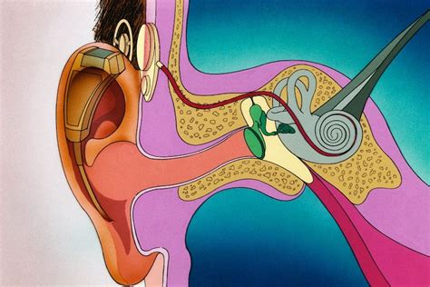 Cochlear implants are labour-intensive to fine-tune, but this man's new algorithm cuts time and ...