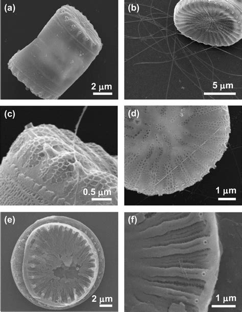 SEM images of Cyclotella diatom cells at the end of stage I, before Ge... | Download Scientific ...