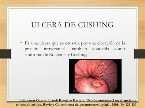 ULCERA DE CURLING PDF