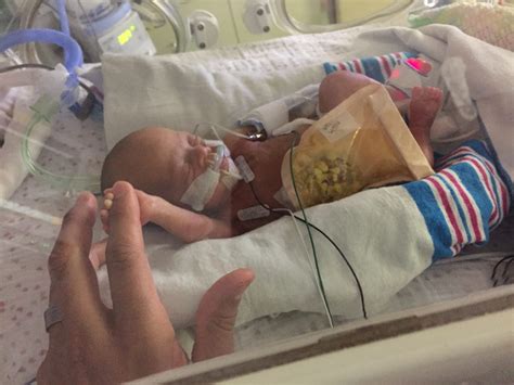 Born premature at 24 weeks, baby Marlo is a 'miracle'