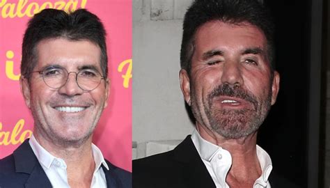 Simon Cowell snapped again with radically transforming face on date night with fiancée Lauren ...