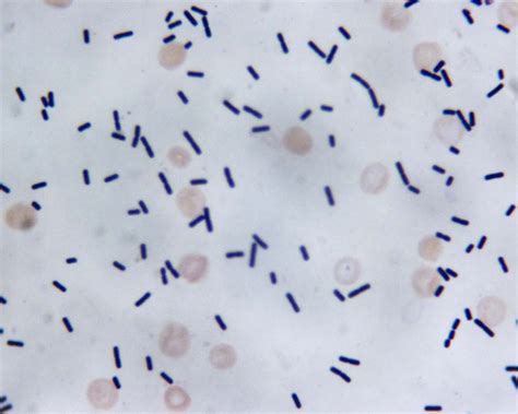 Clostridium Gram Stain