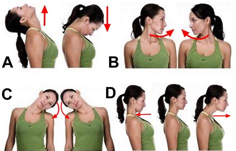 Torticollis in adults, spasmodic torticollis, infant torticollis causes ...