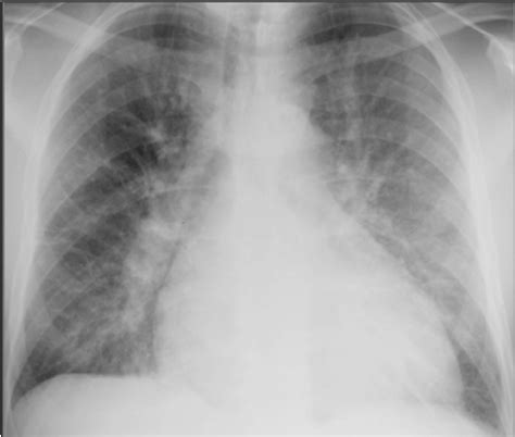 Chest radiograph of different conditions | Geoffrey E. Reed life