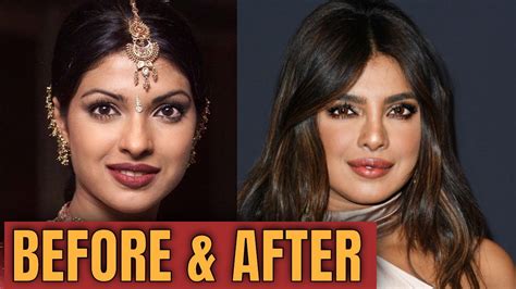 Priyanka Chopra Before Plastic Surgery : Priyanka chopra has warned that plastic surgery should ...