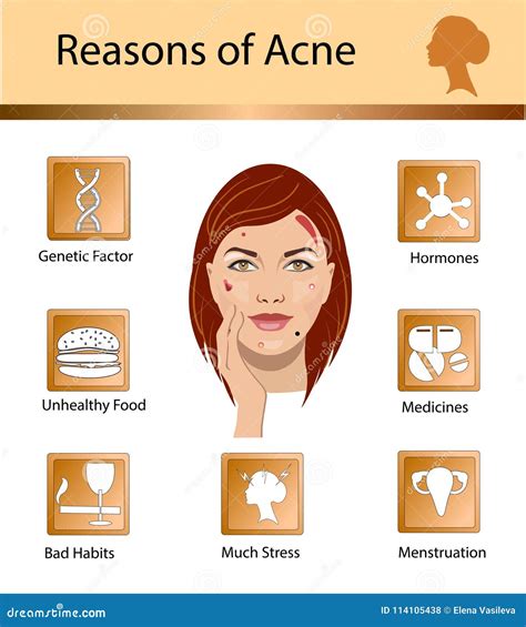 Acne Reasons. Skin Problems and Diseases Beauty Infographics. Vector Illustration Stock Vector ...