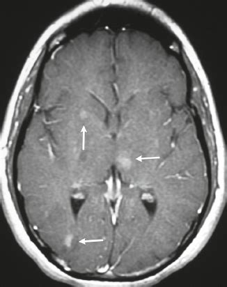 5 Vascular Abnormalities | Radiology Key