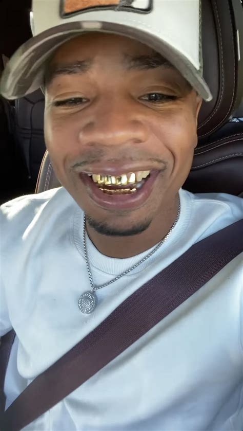 Kanye West Gold Teeth