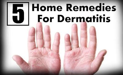 5 Home Remedies for Contact Dermatitis - Natural Remedies And Treatment