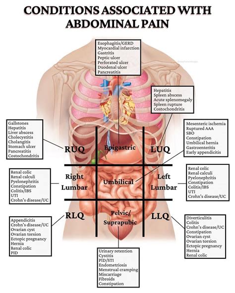 Stephanee Beggs, RN, BSN on Instagram: “WHAT’S CAUSING YOUR ABDOMINAL ...