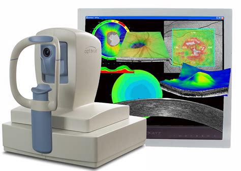 Ocular Coherence Tomography (OCT) | Midwest Eye Associates | Advanced ...