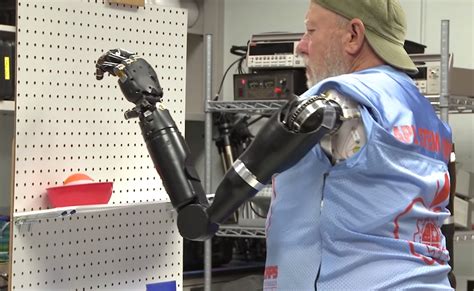 Marvel At Modern Science: Man Uses Prosthetic Arms » Fanboy.com