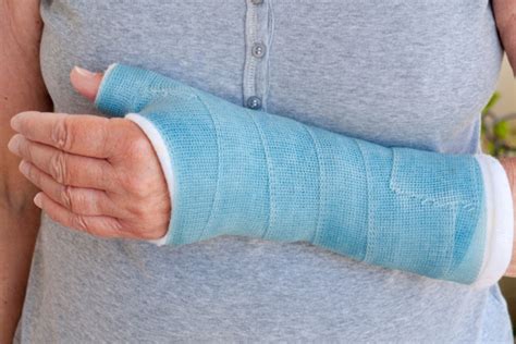 Broken Wrist? What Happens Now | Ladan Hajipour Wrist and Hand Surgeon