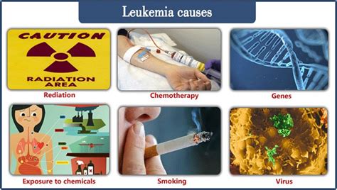 leukemia full list of symptoms Leukemia treatment, diagnosis, causes, symptoms & prognosis