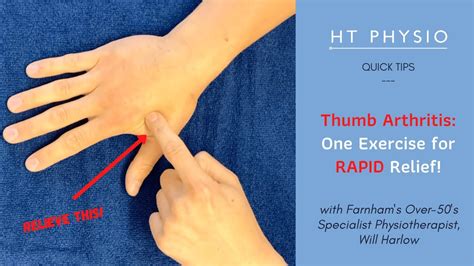 Thumb Arthritis: One Exercise for Rapid Relief | HT Physio Quick Tips ...