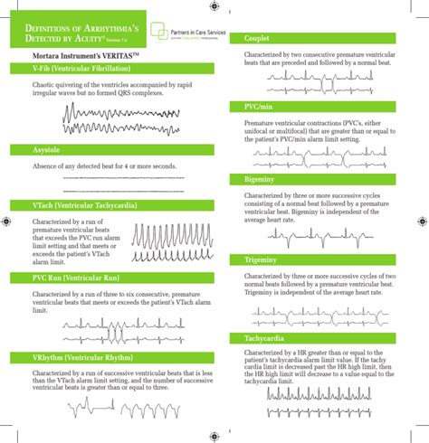 V-Fib (Ventricular Fibrillation) Asystole VTach (Ventricular