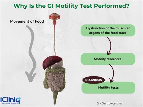 What Is Gastrointestinal Motility Test?