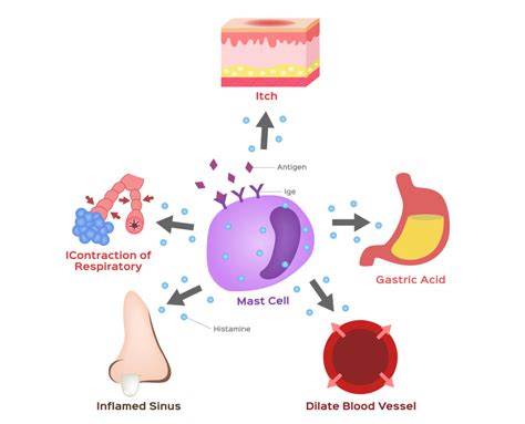 Histamine Intolerance: Everything You Need to Know - Dr. Robert Kiltz