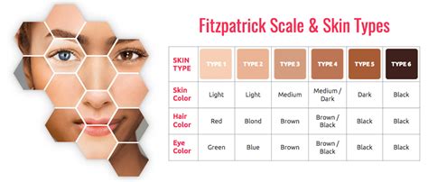 The Fitzpatrick Scale - Buy Permanent Makeup Blog - BuyPermanentMakeup.com