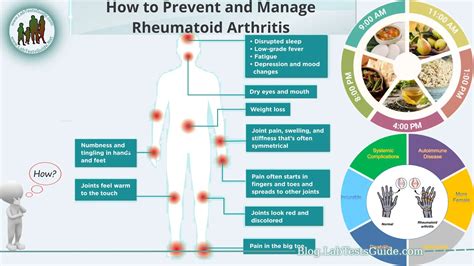 How to Prevent and Manage Rheumatoid Arthritis - Lab Tests Guide Blog