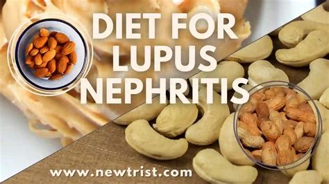 Diet For Lupus Nephritis