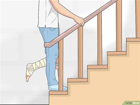 How to Go Upstairs with Crutches With & Without a Railing