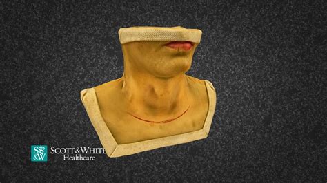 Total Thyroidectomy Surgery - 01 - 3D model by Scott & White Moulage ...