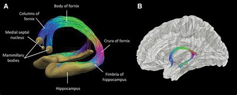 Body Of Fornix - astonishingceiyrs