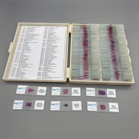 Advanced 100pcs human pathology teaching slides wholesale, university ...