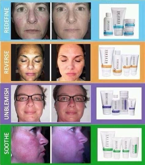 Rodan And Fields Before And After Redefine - All You Need Infos