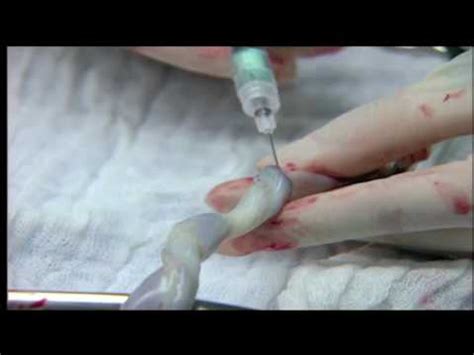 Venous Blood Collection Procedure