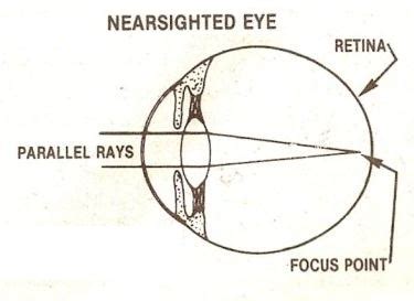 Improve Your Eyesight Naturally with Eye Exercises – Mother Earth News