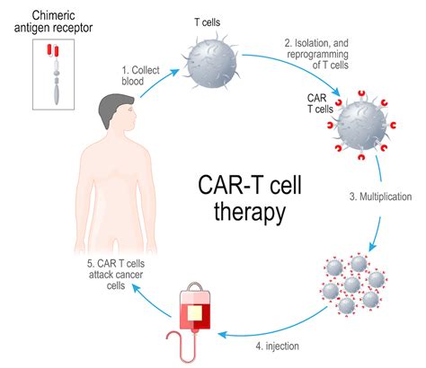 Cancer Immunotherapy Clinical Trials | UCSF Helen Diller Family ...