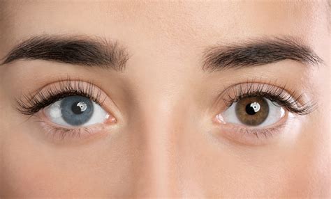 How to Change Eye Color Naturally? Is it Even Possible? - Healthwire