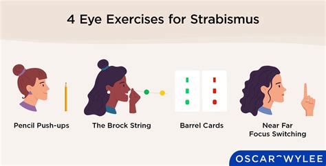 4 Eye Exercises for Strabismus