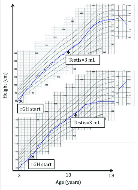 | A typical responder (R) height growth chart (top) compared to a ...